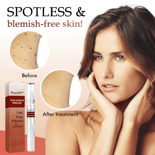 🎁BUY 1 GET 1 FREE🎁WipeOff™ Tags & Moles Remover