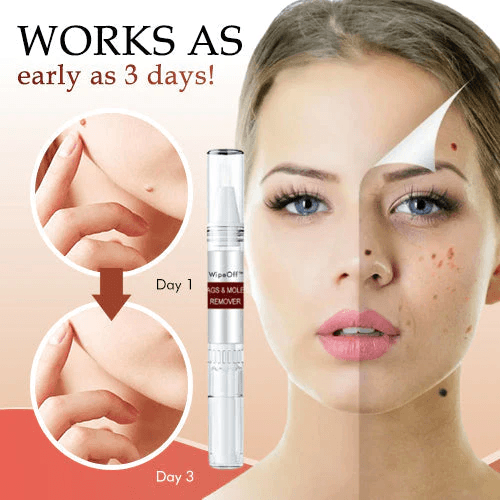 🎁BUY 1 GET 1 FREE🎁WipeOff™ Tags & Moles Remover