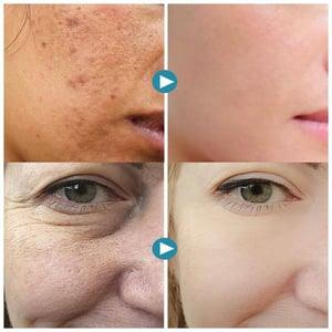 🎁 Magical Perfecting Base Face Primer (🔥BUY 2 GET 1 NOW)
